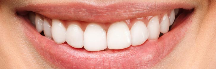 Imagen dental después del tratamiento